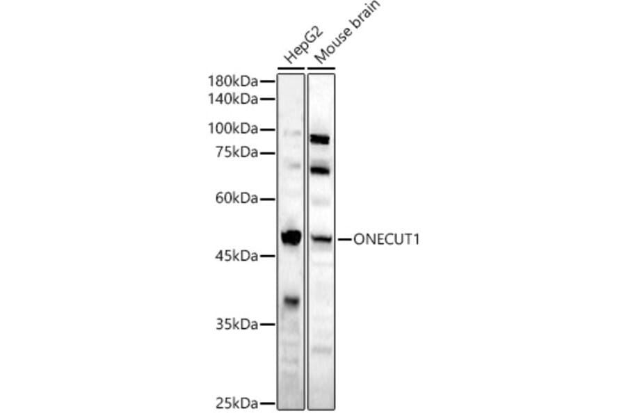 Western Blot - Anti-HNF6 Antibody (A90316) - Antibodies.com