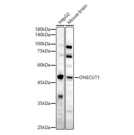 Western Blot - Anti-HNF6 Antibody (A90316) - Antibodies.com