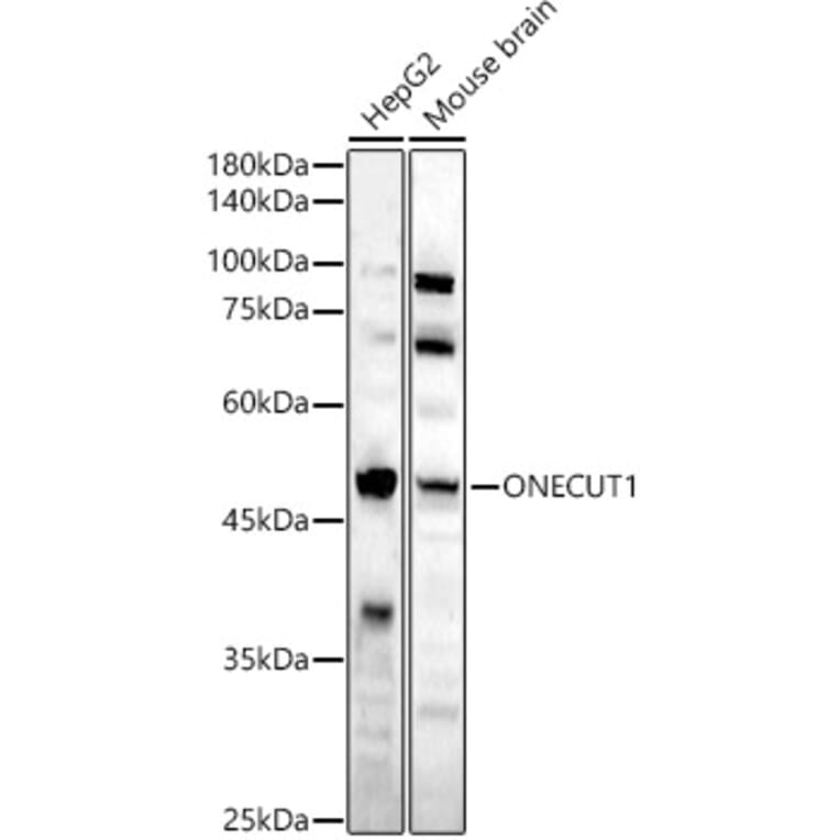 Western Blot - Anti-HNF6 Antibody (A90316) - Antibodies.com