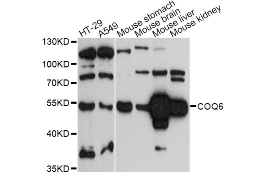 Western Blot - Anti-COQ6 Antibody (A14335) - Antibodies.com