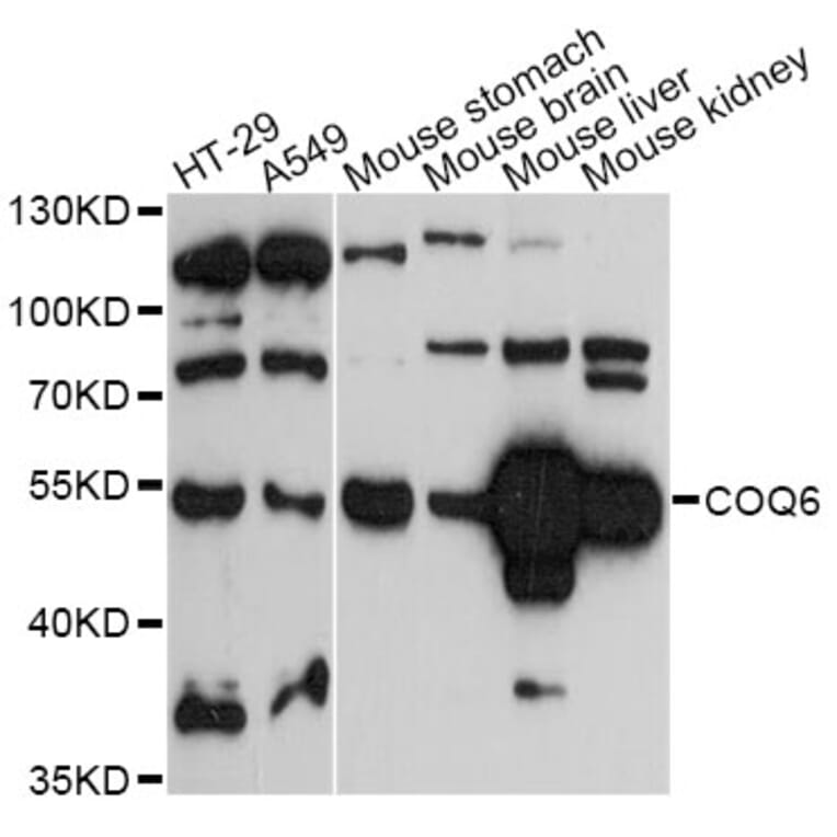 Western Blot - Anti-COQ6 Antibody (A14335) - Antibodies.com