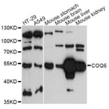 Western Blot - Anti-COQ6 Antibody (A14335) - Antibodies.com