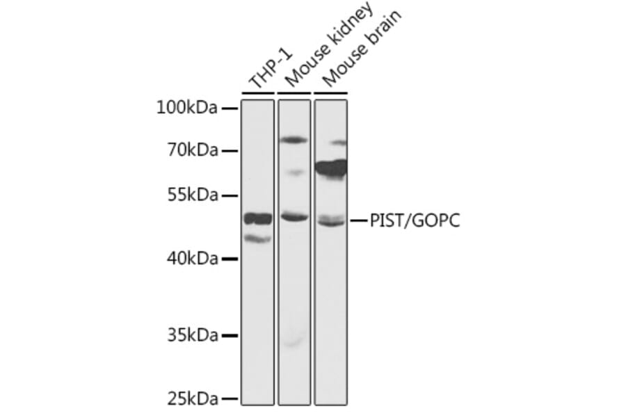 Western Blot - Anti-PIST Antibody (A90318) - Antibodies.com