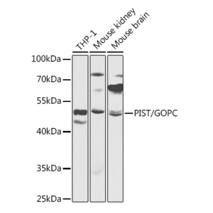 Western Blot - Anti-PIST Antibody (A90318) - Antibodies.com