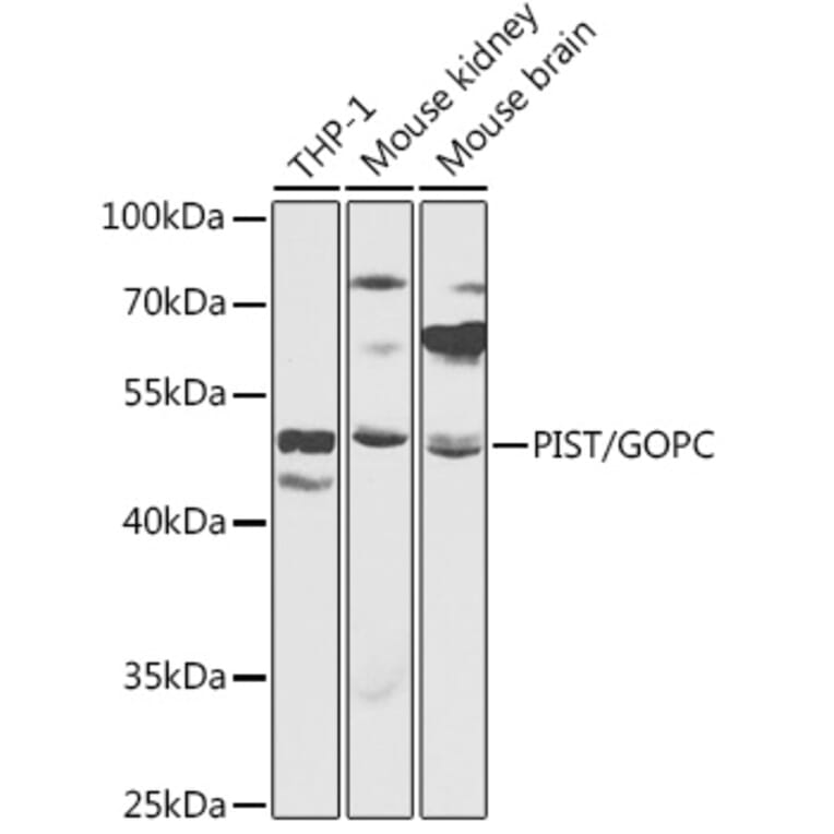 Western Blot - Anti-PIST Antibody (A90318) - Antibodies.com
