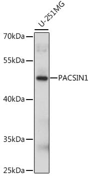 Western blot analysis of extracts of U-251MG cells, using Anti-PACSIN1 Antibody (A15827) at 1:1,000 dilution.
Secondary antibody: Goat Anti-Rabbit IgG (H+L) (HRP) (AS014) at 1:10,000 dilution.
Lysates / proteins: 25µg per lane.
Blocking buffer: 3% non-fat dry milk in TBST.
Detection: ECL Basic Kit (RM00020).
Exposure time: 15s.