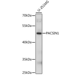 Western Blot - Anti-PACSIN1 Antibody (A90319) - Antibodies.com