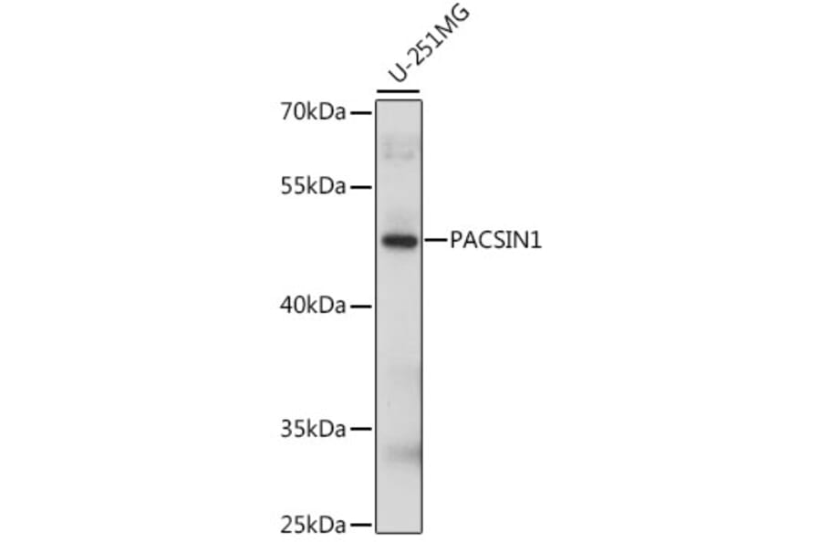 Western Blot - Anti-PACSIN1 Antibody (A90319) - Antibodies.com