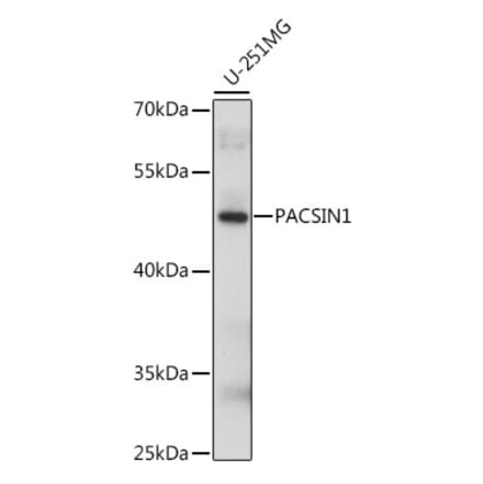 Western Blot - Anti-PACSIN1 Antibody (A90319) - Antibodies.com