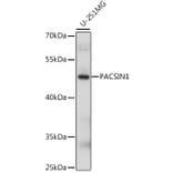 Western Blot - Anti-PACSIN1 Antibody (A90319) - Antibodies.com