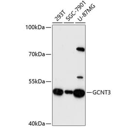 Western Blot - Anti-GCNT3 Antibody (A90320) - Antibodies.com