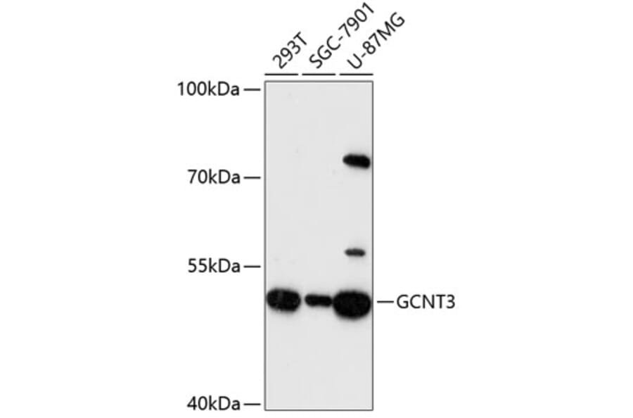 Western Blot - Anti-GCNT3 Antibody (A90320) - Antibodies.com