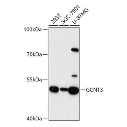 Western Blot - Anti-GCNT3 Antibody (A90320) - Antibodies.com