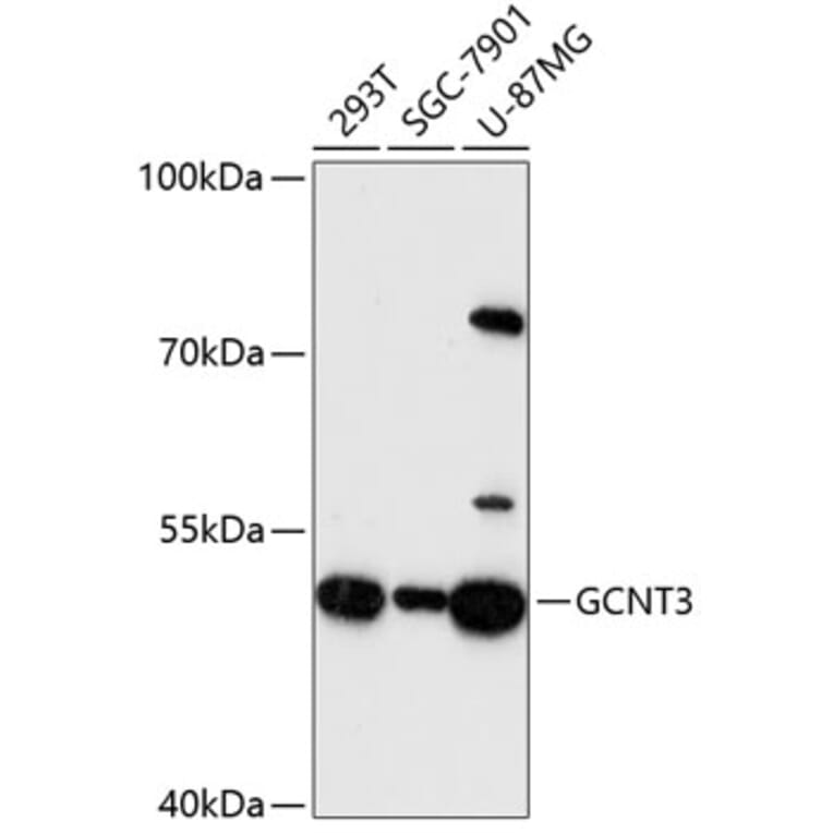 Western Blot - Anti-GCNT3 Antibody (A90320) - Antibodies.com