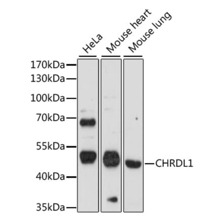 Western Blot - Anti-CHRDL1 Antibody (A90321) - Antibodies.com