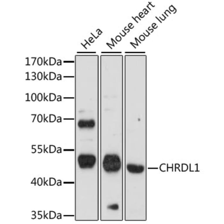 Western Blot - Anti-CHRDL1 Antibody (A90321) - Antibodies.com