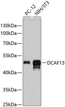 Western blot analysis of extracts of various cell lines, using Anti-DCAF13 Antibody (A13213) at 1:3000 dilution.
Secondary antibody: Goat Anti-Rabbit IgG (H+L) (HRP) (AS014) at 1:10,000 dilution.
Lysates / proteins: 25µg per lane.
Blocking buffer: 3% non-fat dry milk in TBST.
Detection: ECL Basic Kit (RM00020).
Exposure time: 15s.