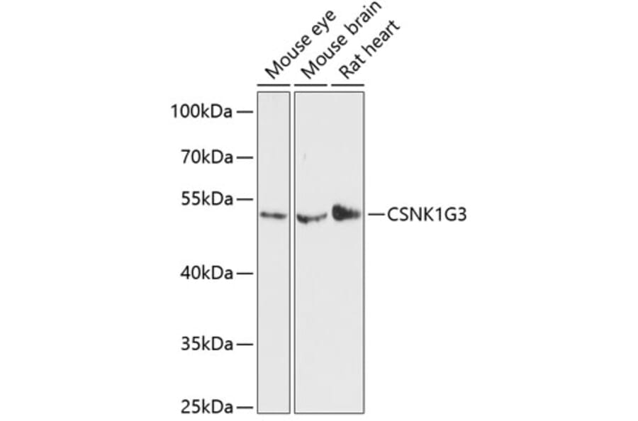Western Blot - Anti-CSNK1G3 Antibody (A90323) - Antibodies.com