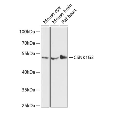 Western Blot - Anti-CSNK1G3 Antibody (A90323) - Antibodies.com