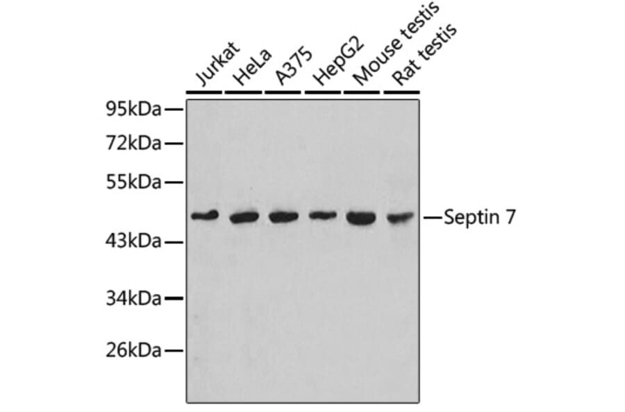 Western Blot - Anti-SEPT7 Antibody (A90324) - Antibodies.com