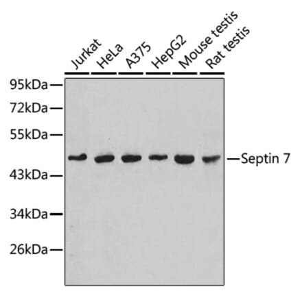 Western Blot - Anti-SEPT7 Antibody (A90324) - Antibodies.com