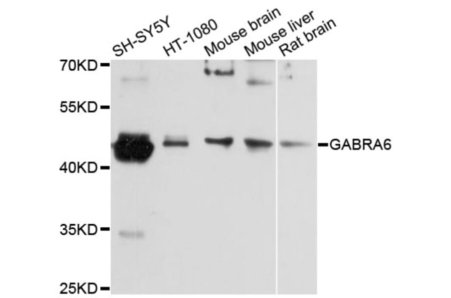 Western Blot - Anti-GABRA6 Antibody (A12750) - Antibodies.com