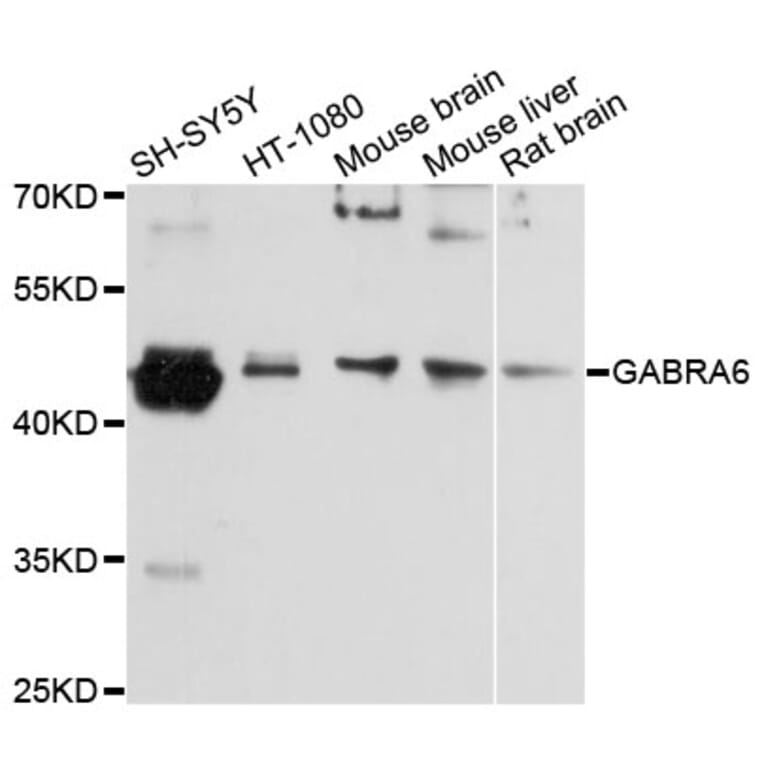 Western Blot - Anti-GABRA6 Antibody (A12750) - Antibodies.com