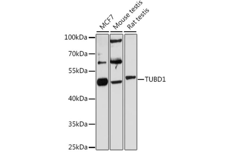 Western Blot - Anti-TUBD1 Antibody (A13091) - Antibodies.com