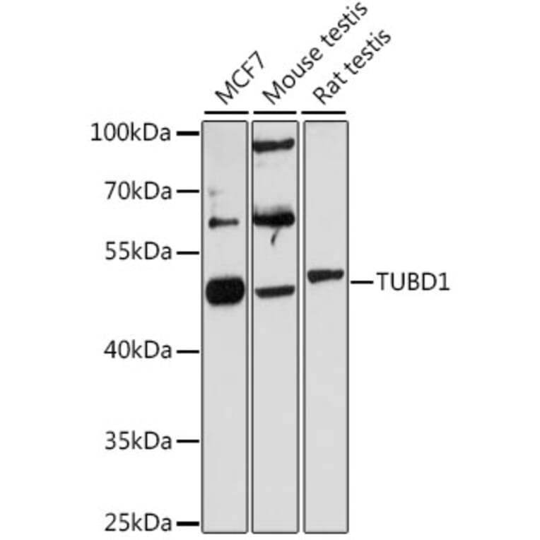 Western Blot - Anti-TUBD1 Antibody (A13091) - Antibodies.com