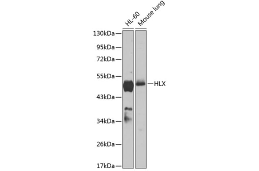 Western Blot - Anti-HLX1 Antibody (A90328) - Antibodies.com