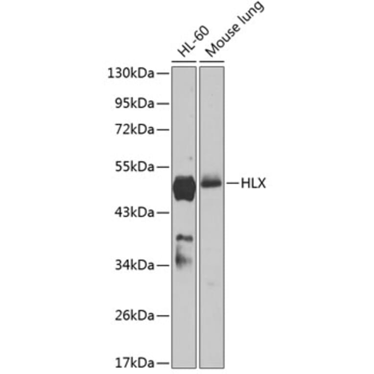Western Blot - Anti-HLX1 Antibody (A90328) - Antibodies.com