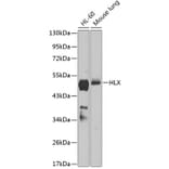Western Blot - Anti-HLX1 Antibody (A90328) - Antibodies.com