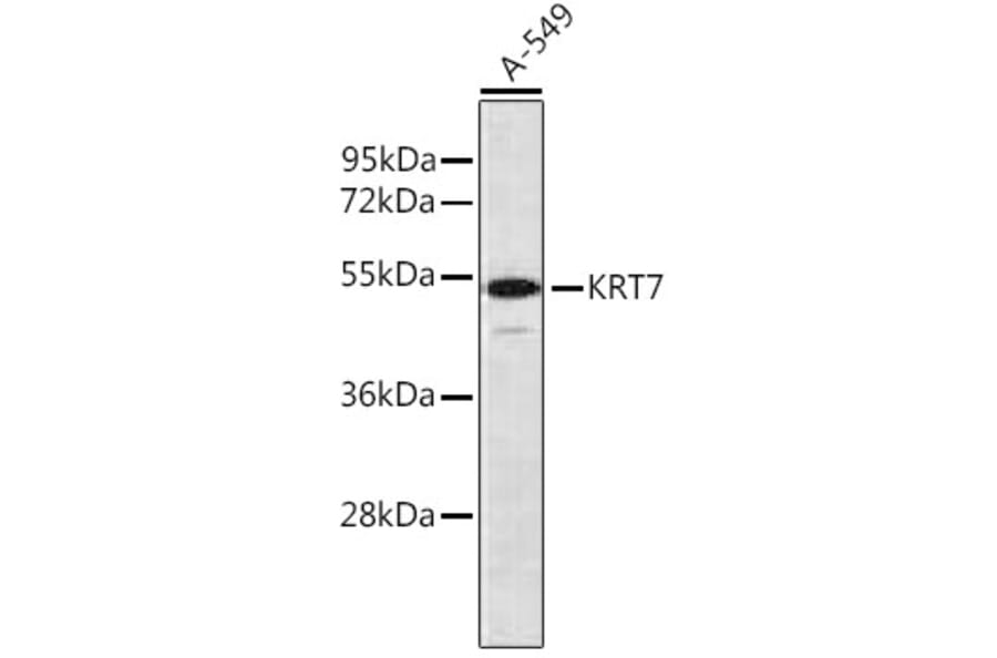 Western Blot - Anti-Keratin Antibody (A16013) - Antibodies.com