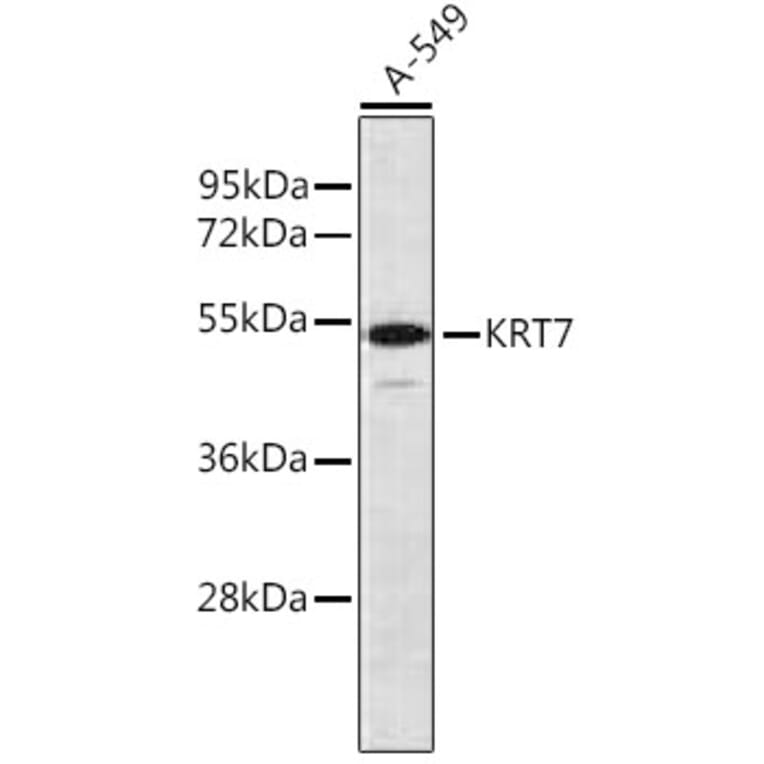 Western Blot - Anti-Keratin Antibody (A16013) - Antibodies.com