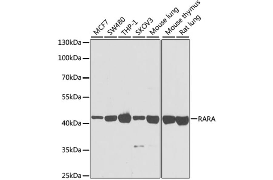 Western Blot - Anti-RARA Antibody (A14057) - Antibodies.com