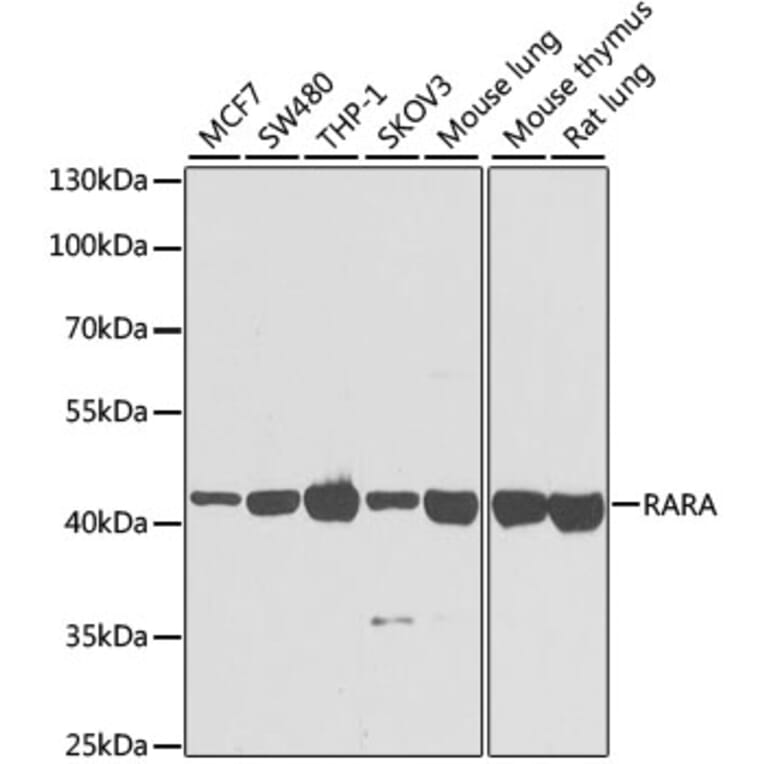 Western Blot - Anti-RARA Antibody (A14057) - Antibodies.com