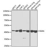 Western Blot - Anti-RARA Antibody (A14057) - Antibodies.com