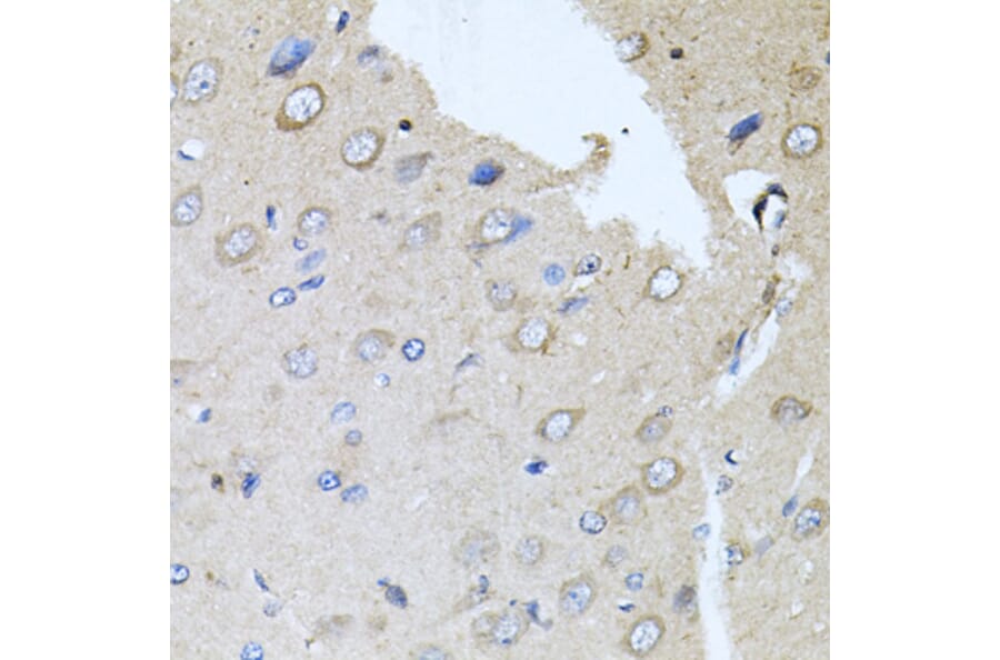 Immunohistochemistry - Anti-RARA Antibody (A14057) - Antibodies.com
