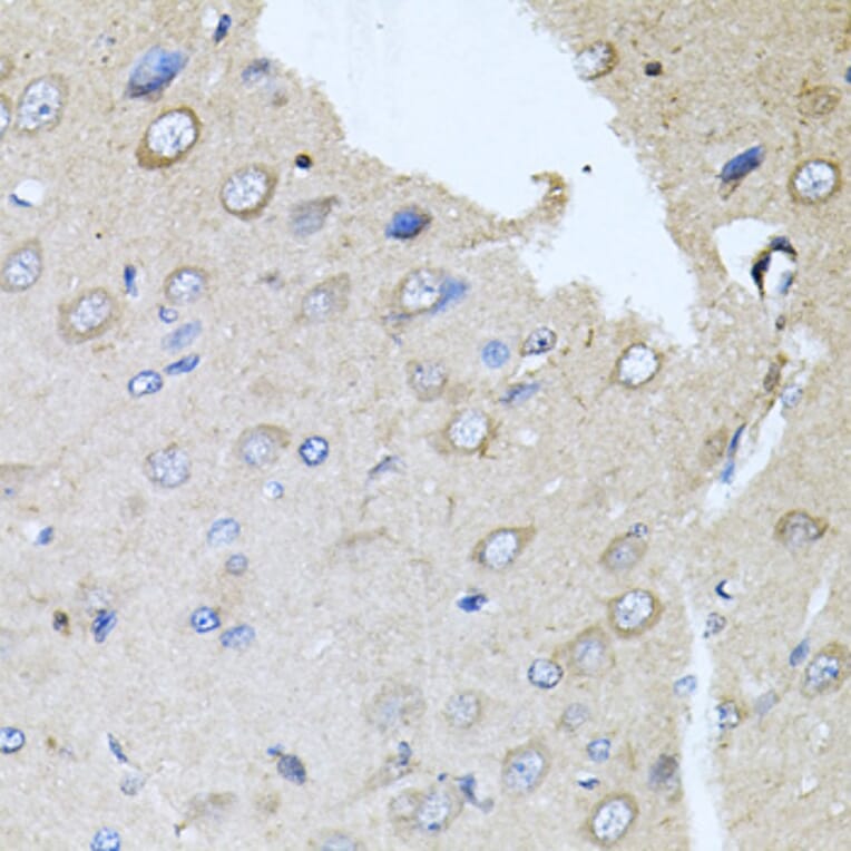 Immunohistochemistry - Anti-RARA Antibody (A14057) - Antibodies.com