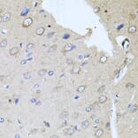 Immunohistochemistry - Anti-RARA Antibody (A14057) - Antibodies.com