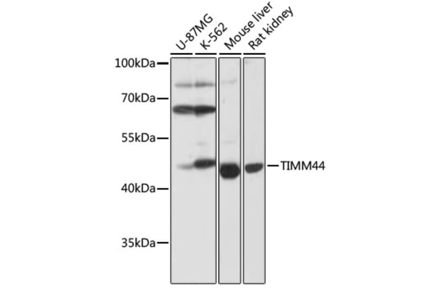 Western Blot - Anti-TIM44 Antibody (A90331) - Antibodies.com