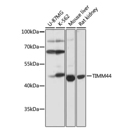 Western Blot - Anti-TIM44 Antibody (A90331) - Antibodies.com