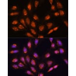 Immunofluorescence - Anti-TIM44 Antibody (A90331) - Antibodies.com