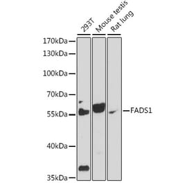 Western Blot - Anti-FADS1 Antibody (A90332) - Antibodies.com