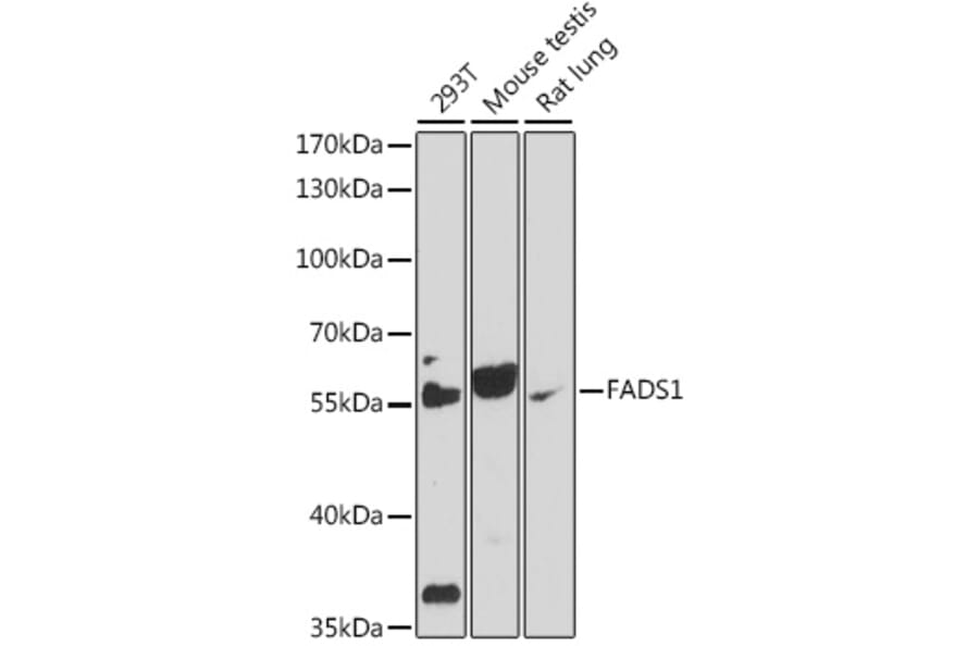 Western Blot - Anti-FADS1 Antibody (A90332) - Antibodies.com