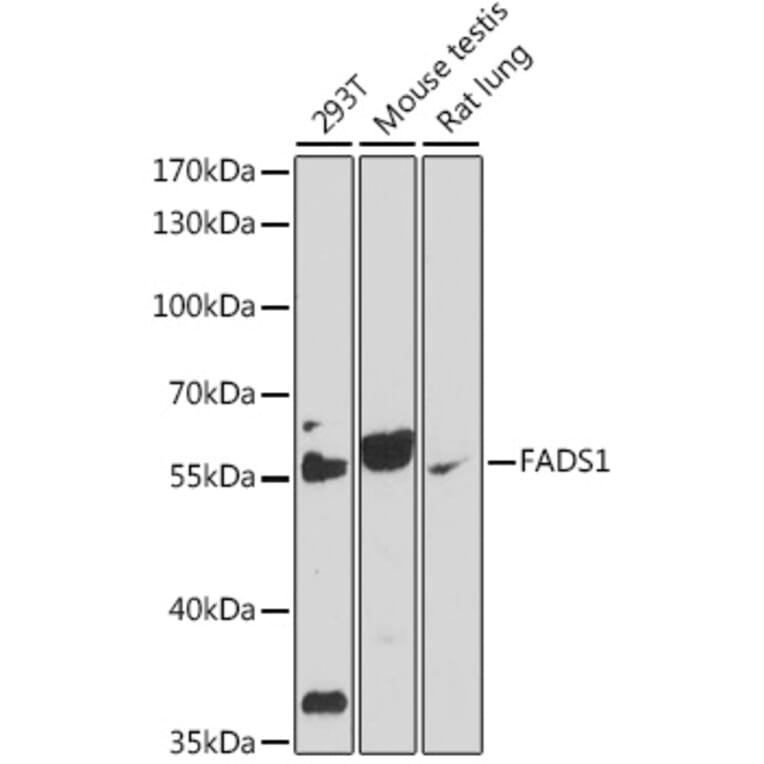 Western Blot - Anti-FADS1 Antibody (A90332) - Antibodies.com