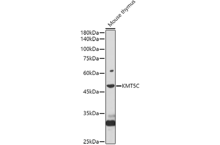Western Blot - Anti-KMT5C/SUV4-2h2 Antibody (A90333) - Antibodies.com