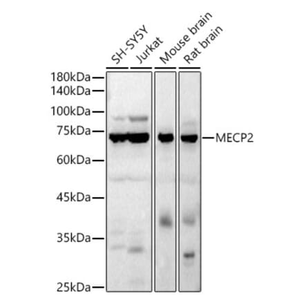 Western Blot - Anti-MeCP2 Antibody (A90334) - Antibodies.com