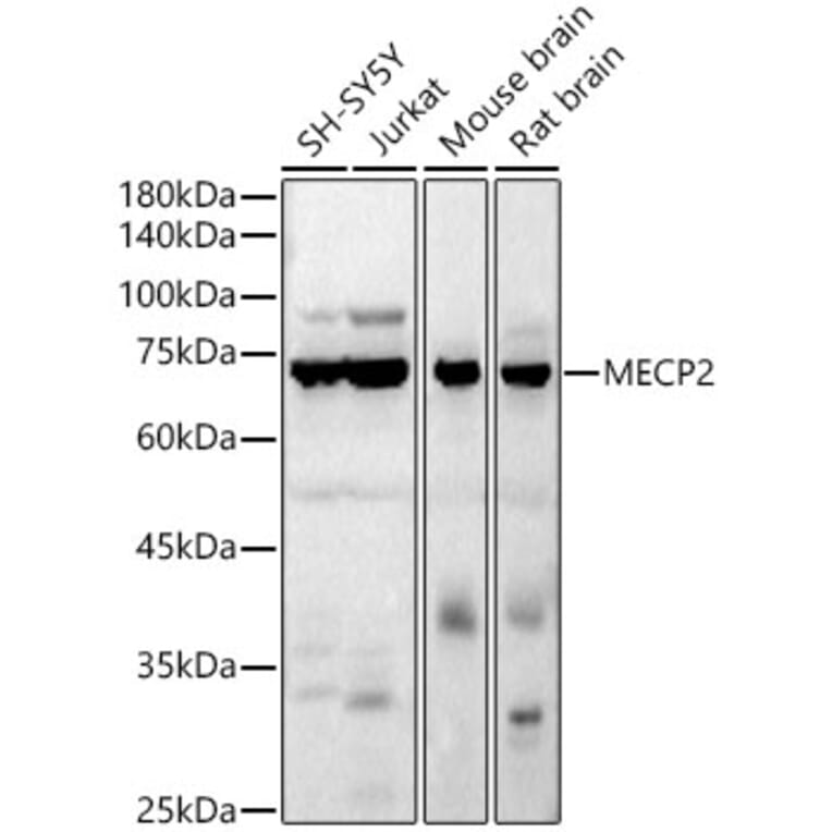 Western Blot - Anti-MeCP2 Antibody (A90334) - Antibodies.com