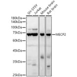 Western Blot - Anti-MeCP2 Antibody (A90334) - Antibodies.com